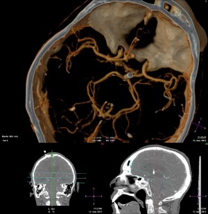 Teleradiology -software